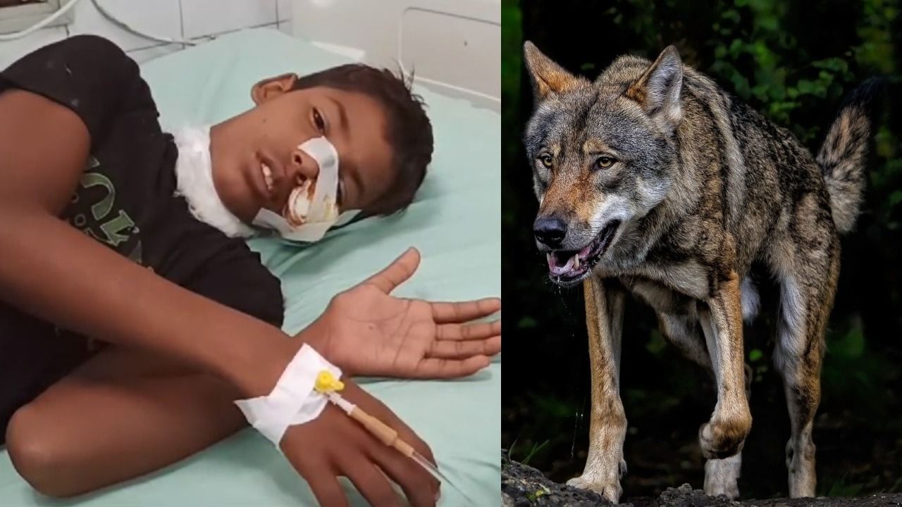 child injured bahraich wolf attack 1726749913194 16 9 VknPP0