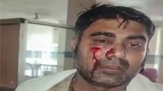 Tonk Violence: राजस्थान के टोंक में पत्रकारों पर लाठी-डंडों से हमला, कैमरा छीनकर जलाया