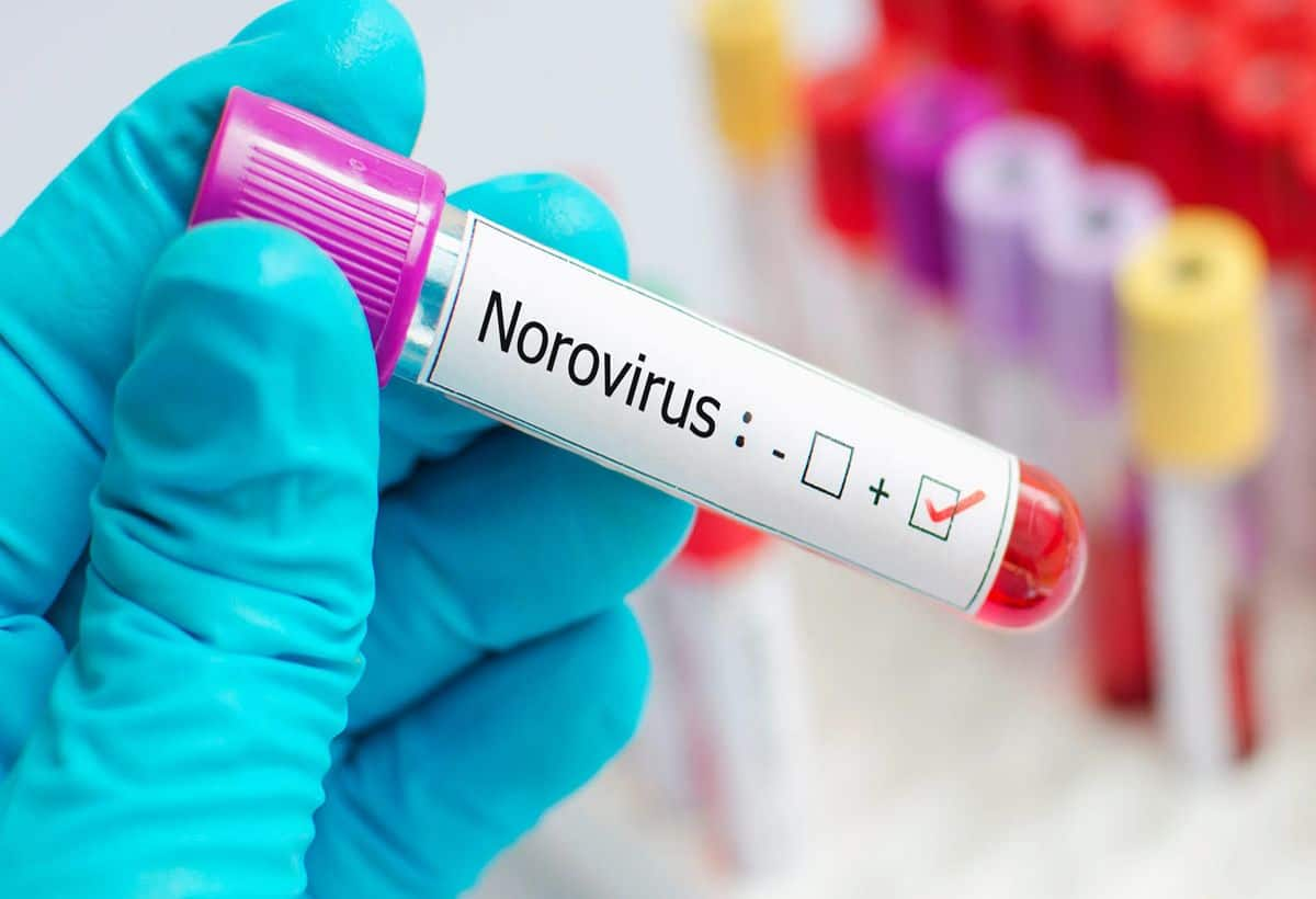 Norovirus cKzDZQ